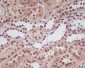 Anti-HIF-1 alpha Rabbit Monoclonal Antibody